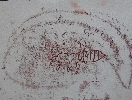 Bed bug